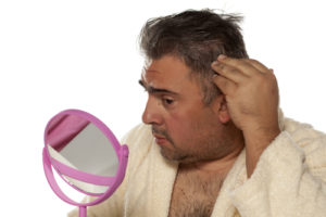 male pattern baldness treatment