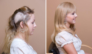 Let the Tango team help you with female hair loss treatment in Brisbane